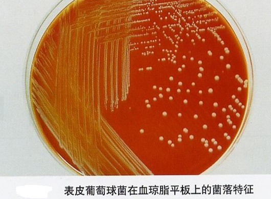 表皮葡萄球菌在血瓊脂平板上的菌落特征